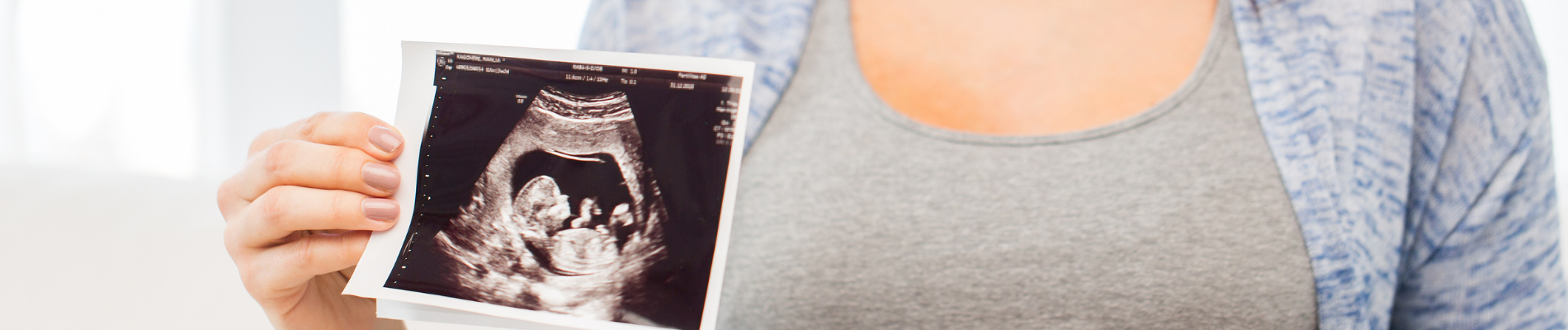 person showing ultrasound pictures